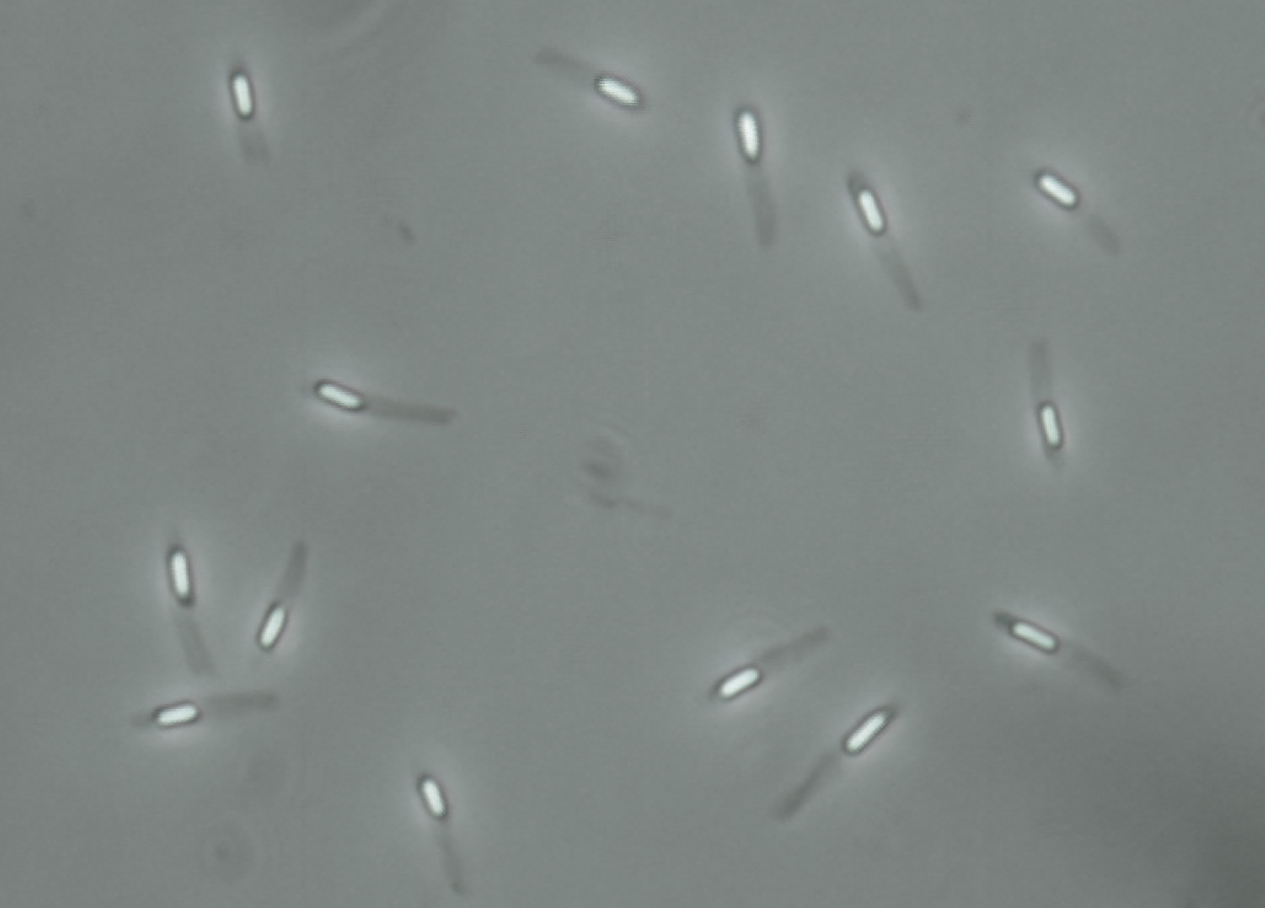 b subtilis endospore stain b subtilis endospore stain