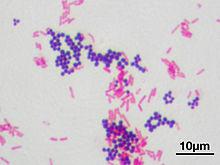 micrococcus luteus acid fast stain