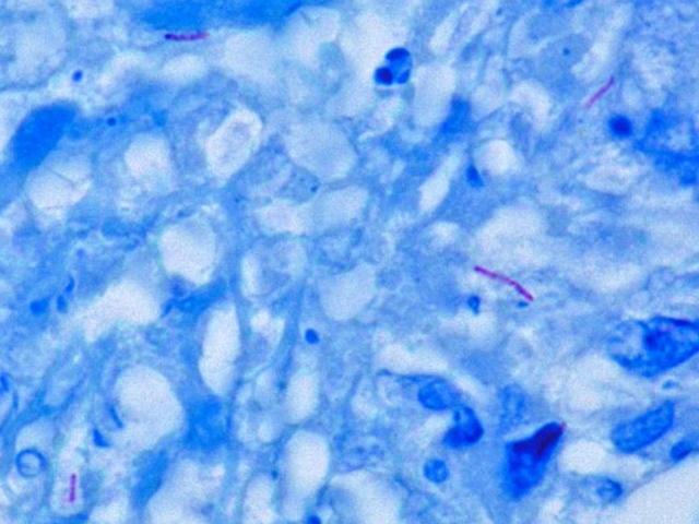 staphylococcus epidermidis endospore stain