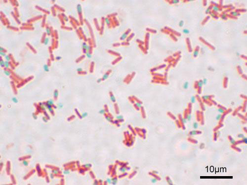 Lab 5-5 Endospore stain.jpg