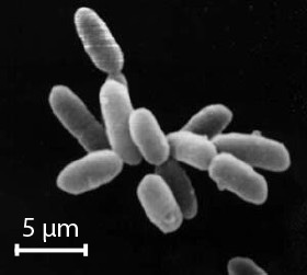 Cells of Halobacterium, image taken by a high-powered microscope. The individual cells in this image are about 5 microns long (scale is only approximate)