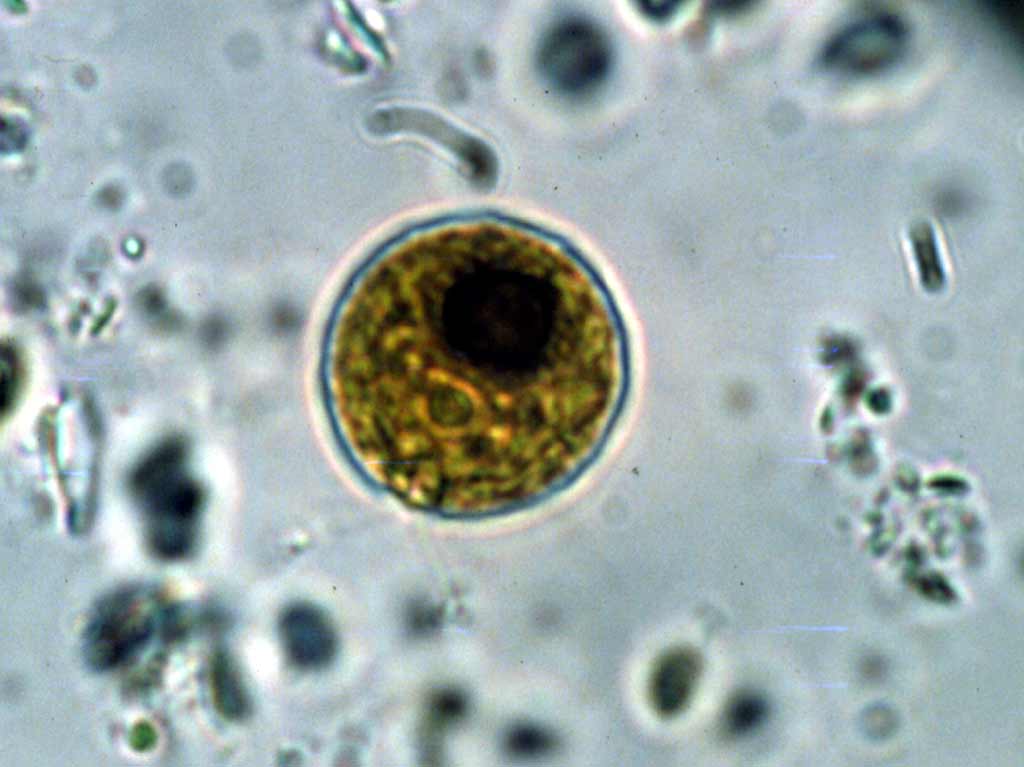 microscopic view of Chlamydomonas