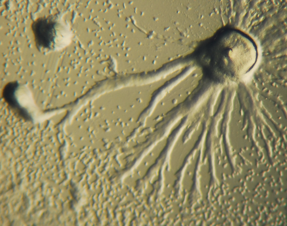 plasmodial slime molds under microscope