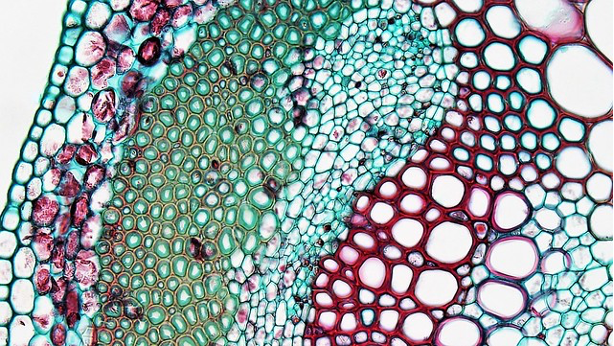 The dicot stem shows vascular bundles and the xylem tissue