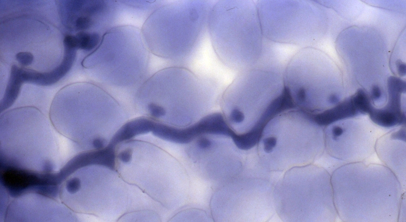Hyphea of Hyaloperonospora parasitica (downy mildew) growing within the leaf of a compatible (susceptible) Arabidopsis thaliana (cf.wikipedia) observed by bright-field microscopy. The staining with trypan blue makes the cytoplasm of H. parasitica dark blue. The long structure is the hyphea, whereas the little sphere are haustoria. This is the vegetative step of the short life cycle of H. parasitica.